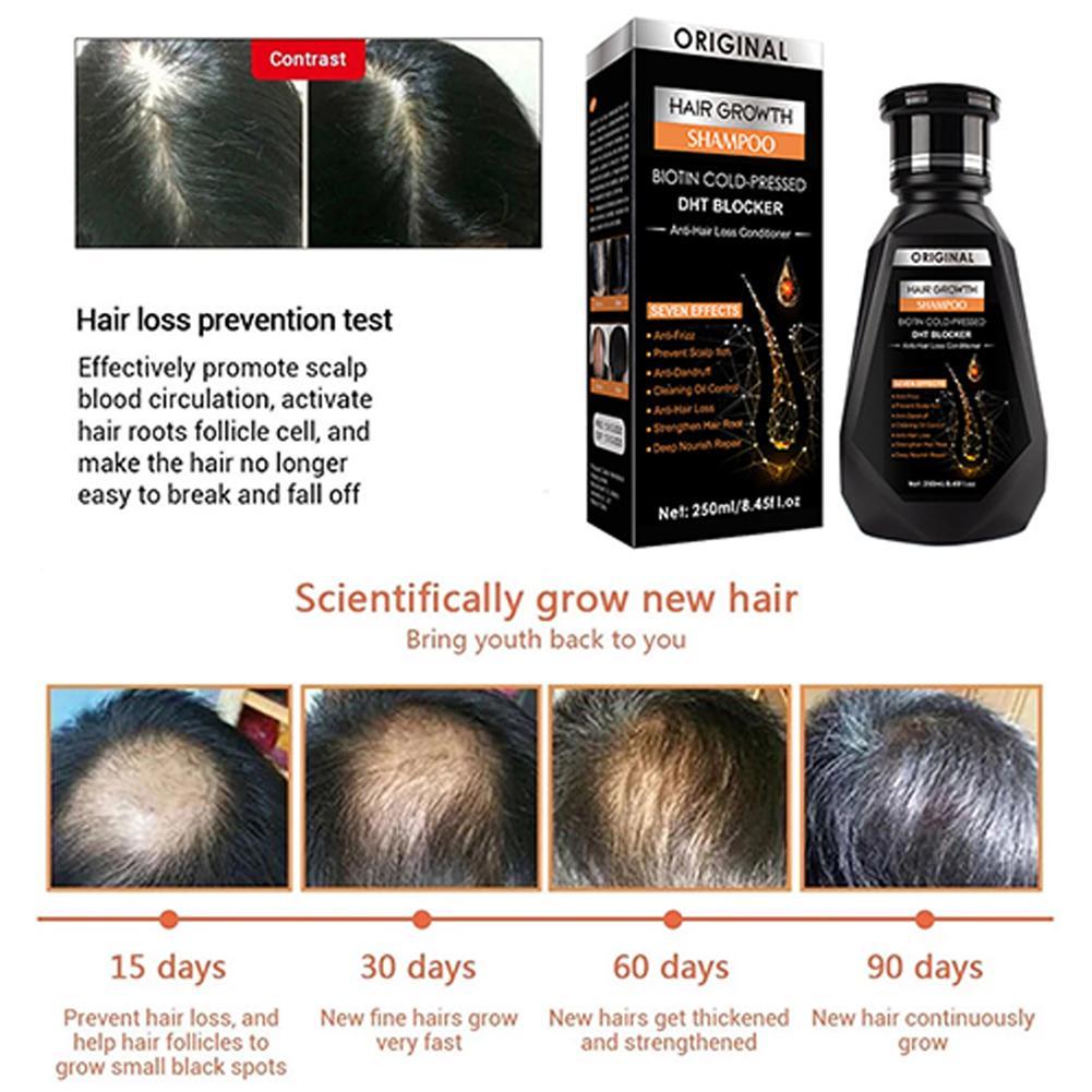 Biotina Shampoo allo zenzero F - Biotin Shampoo Thickening recensione e prezzo
